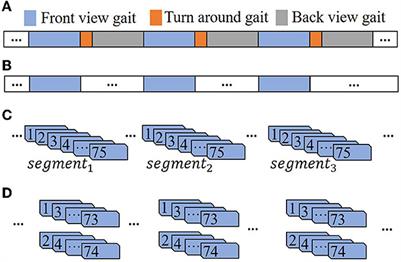 Using gait videos to automatically assess anxiety